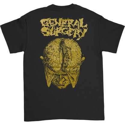 General Surgery Gold Brain T-shirt